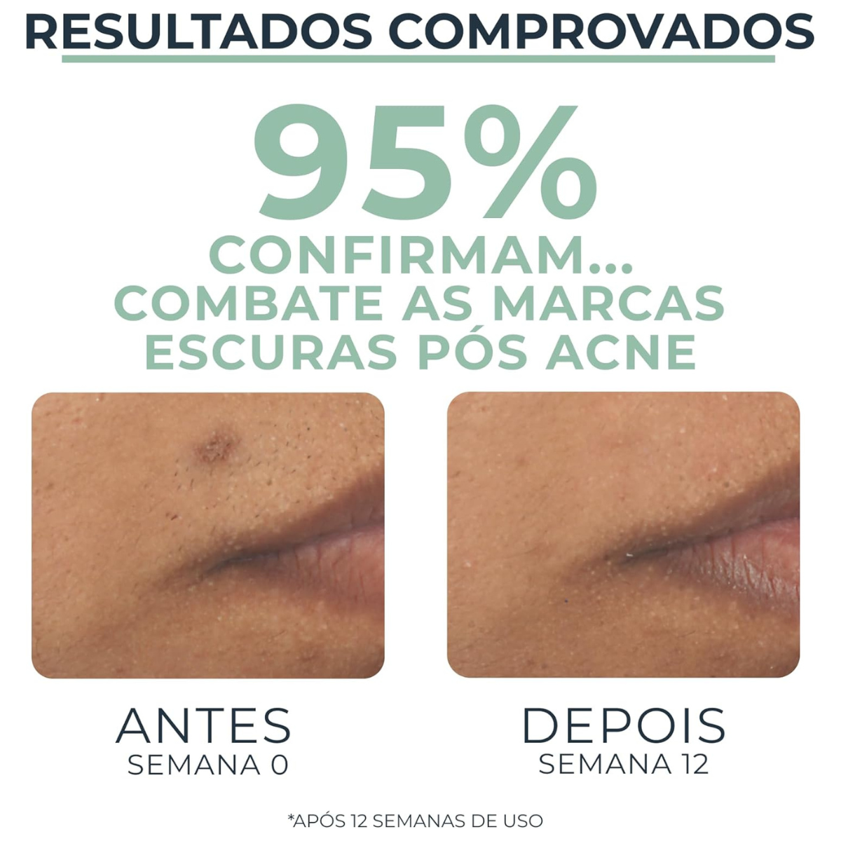 Dermo Pure Sérum Facial Efeito Triplo 40ml