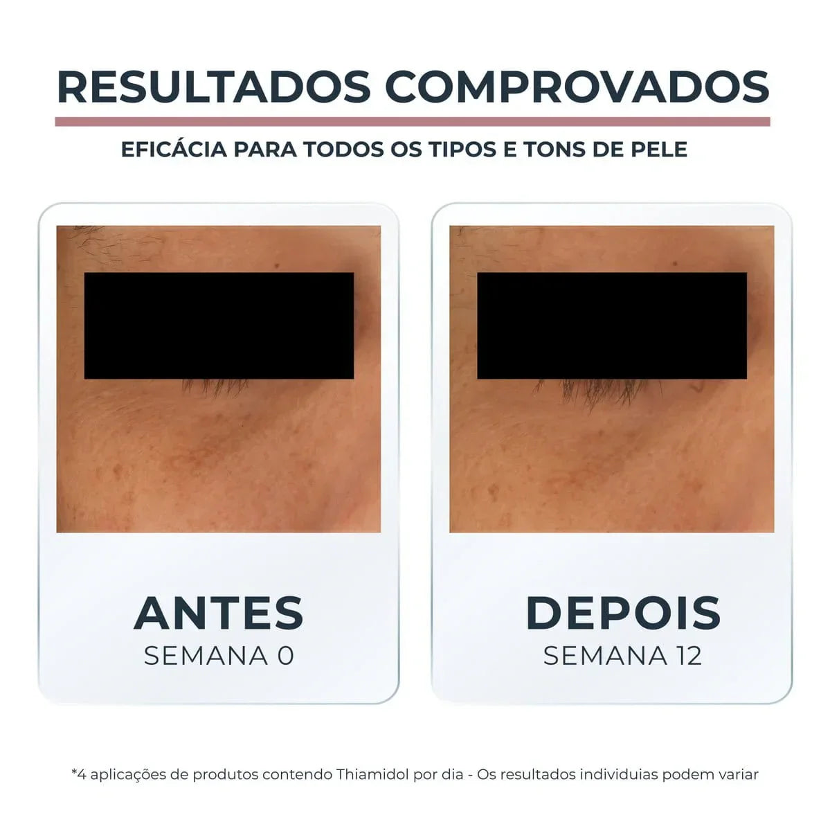 Anti-Pigment Creme Clareador de Olheiras 15ml
