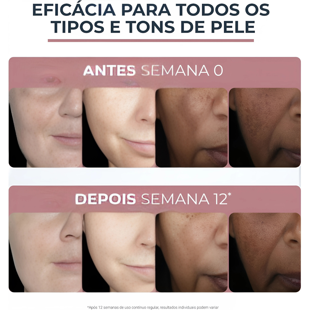 Anti-Pigment Dual Sérum Clareador Facial 30ml